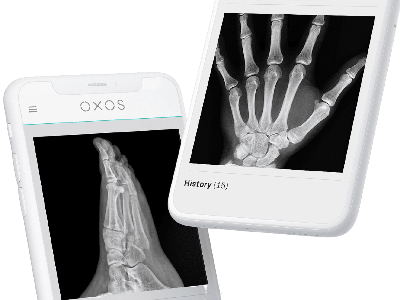 X-Rays Displayed on Handheld Devices