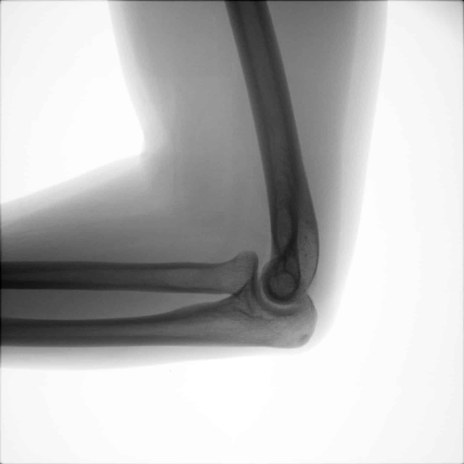 Bioskills OXOS Medical Safe Simple Smart X ray